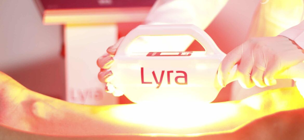 Benefícios da luz intensa pulsada