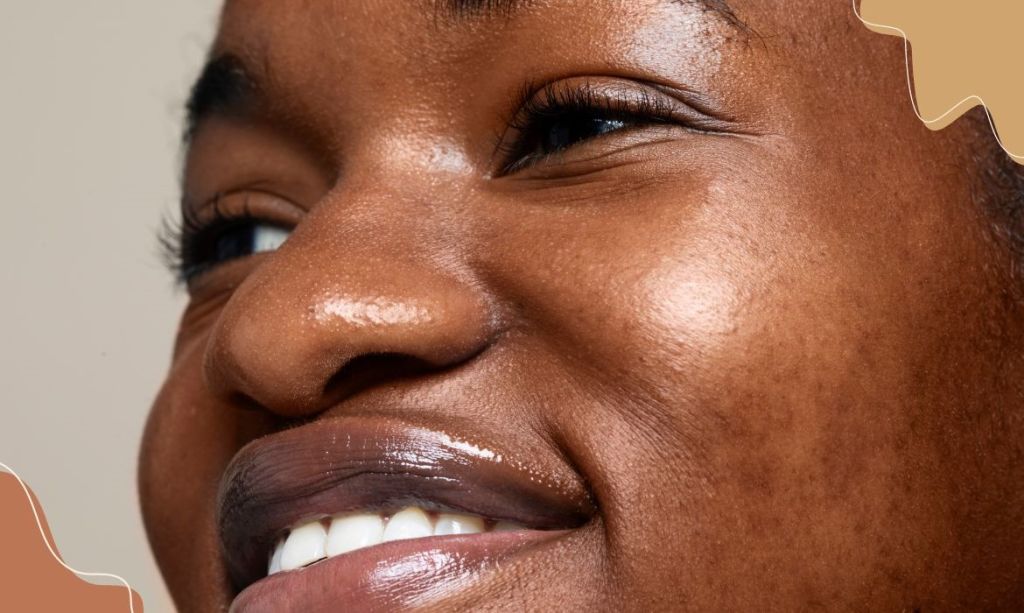 Mulher negra sorrindo de perto mostrando as texturas naturais da pele - BCMED Tratamentos estéticos para pele negra: 5 Opções seguras e eficientes! 