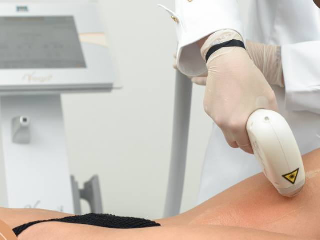 Depilação a Laser com aparelho VEGA da Ibramed.