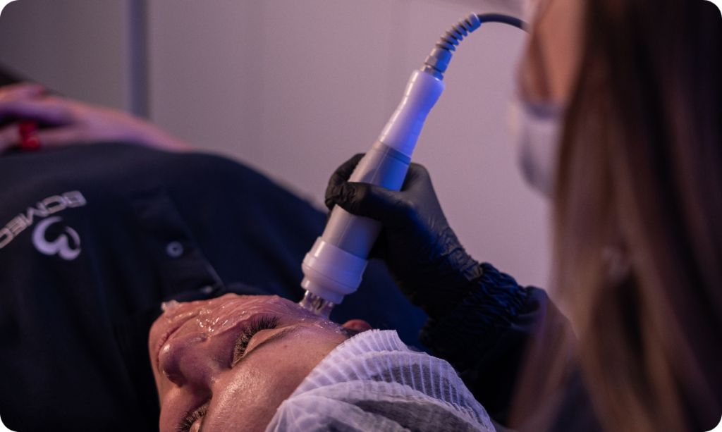 radiofrequência intima
estética íntima