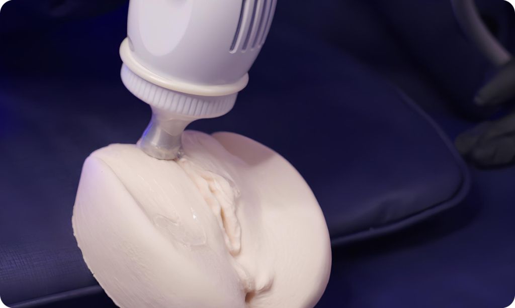 radiofrequência intima
estética íntima