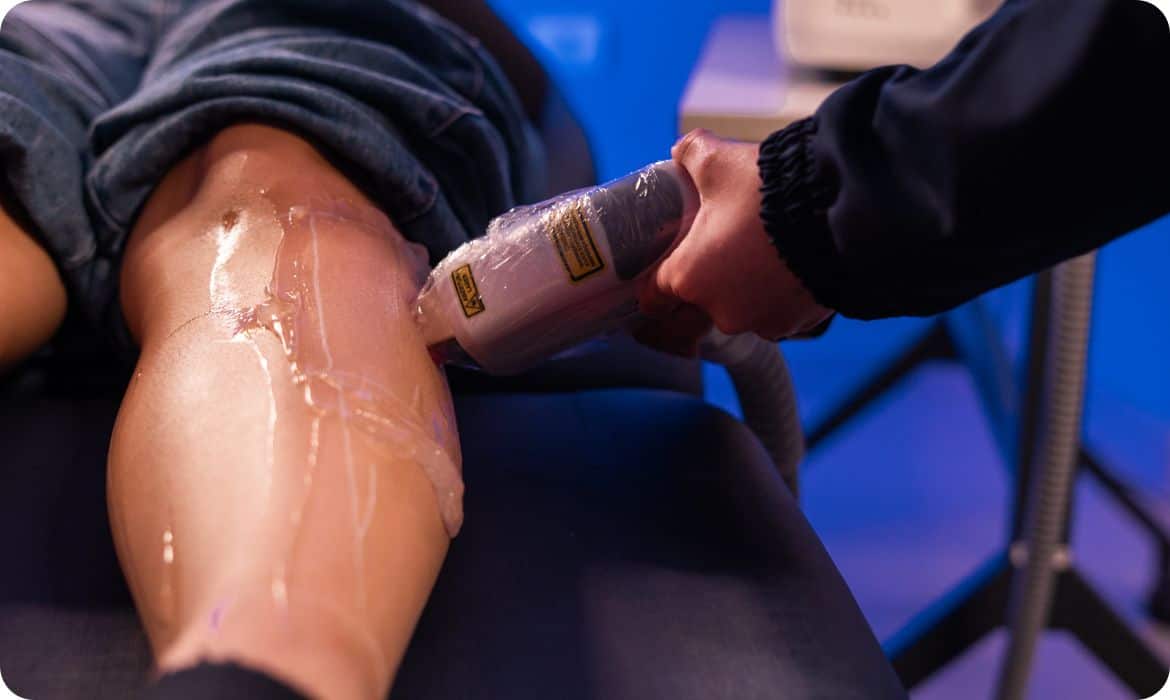 Estética no inverno: Depilação a laser