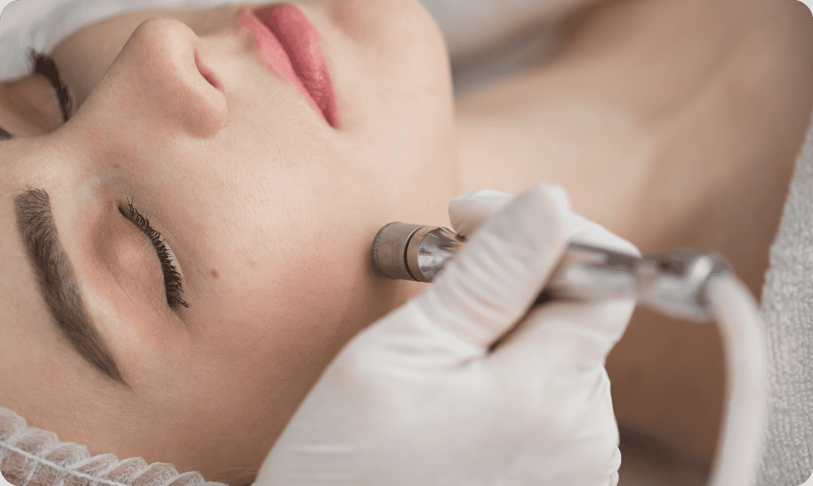 Pascoa na Estética - Peeling de Diamante