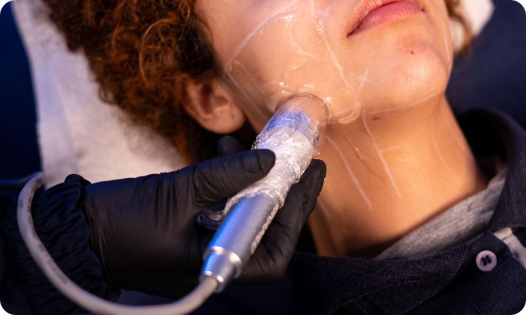 Ultrassom microfocado no rosto, aplicação visage